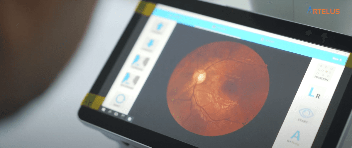 How Artelus is harnessing the power of AI in detecting Diabetic Retinopathy