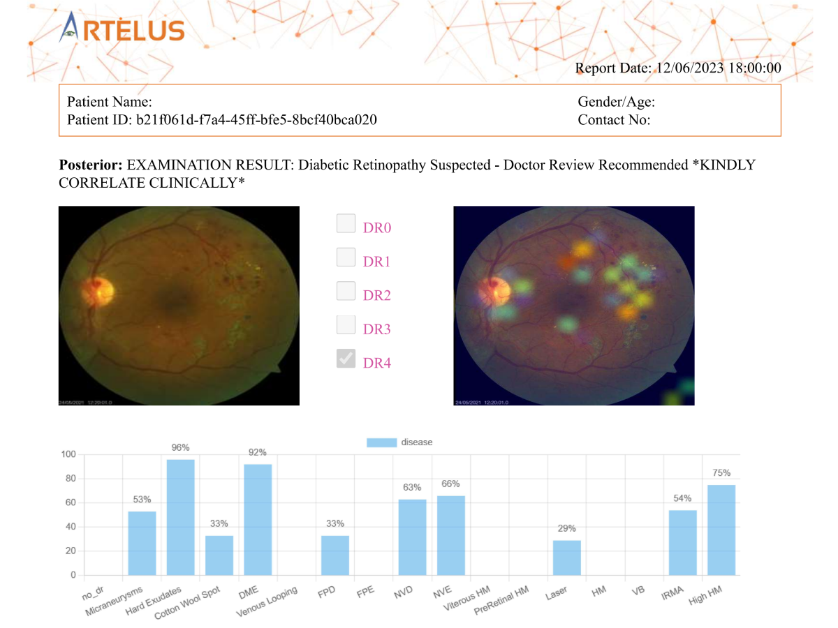 Pradeep Walia Artelus dristi AI report