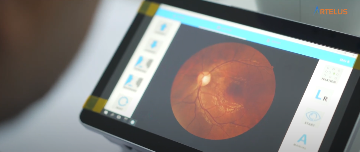 AI in Diabetic Retinopathy Detection